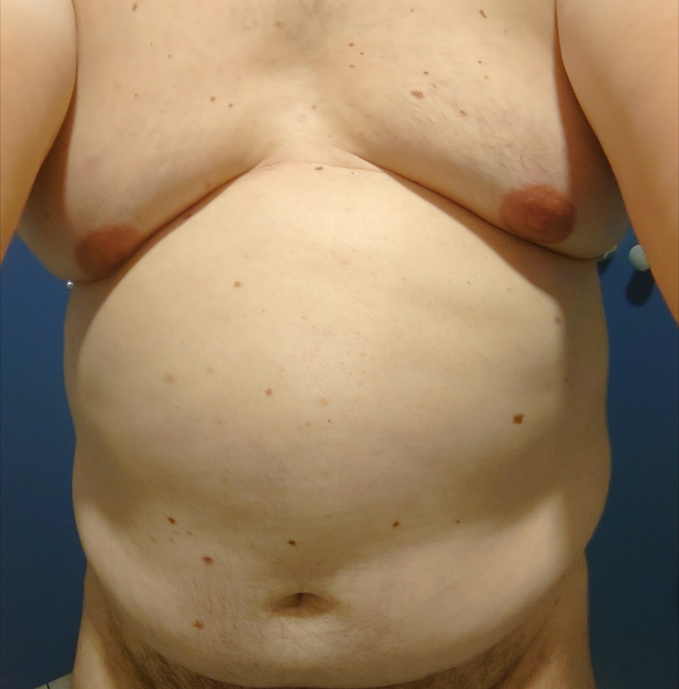 Willian - Rüegsauschachen - Berne | Strip Tease