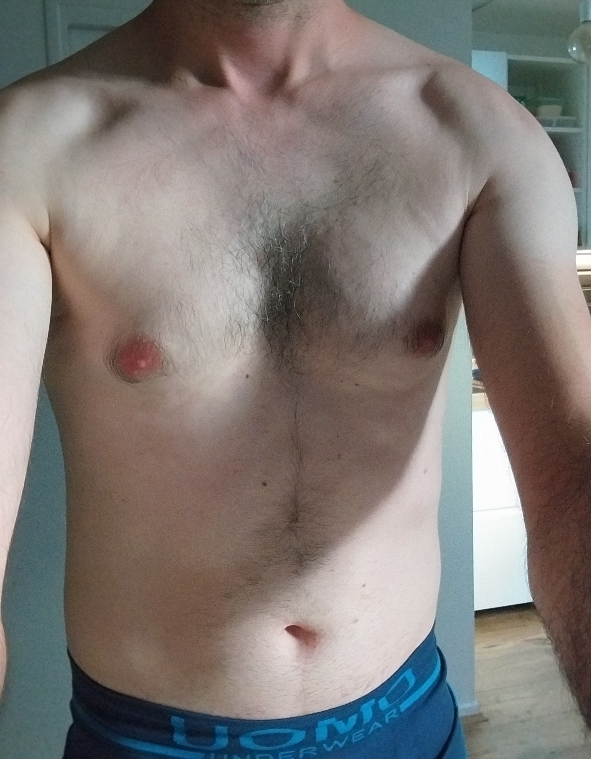 Telio - Dürrenroth - Berne | Strip Tease