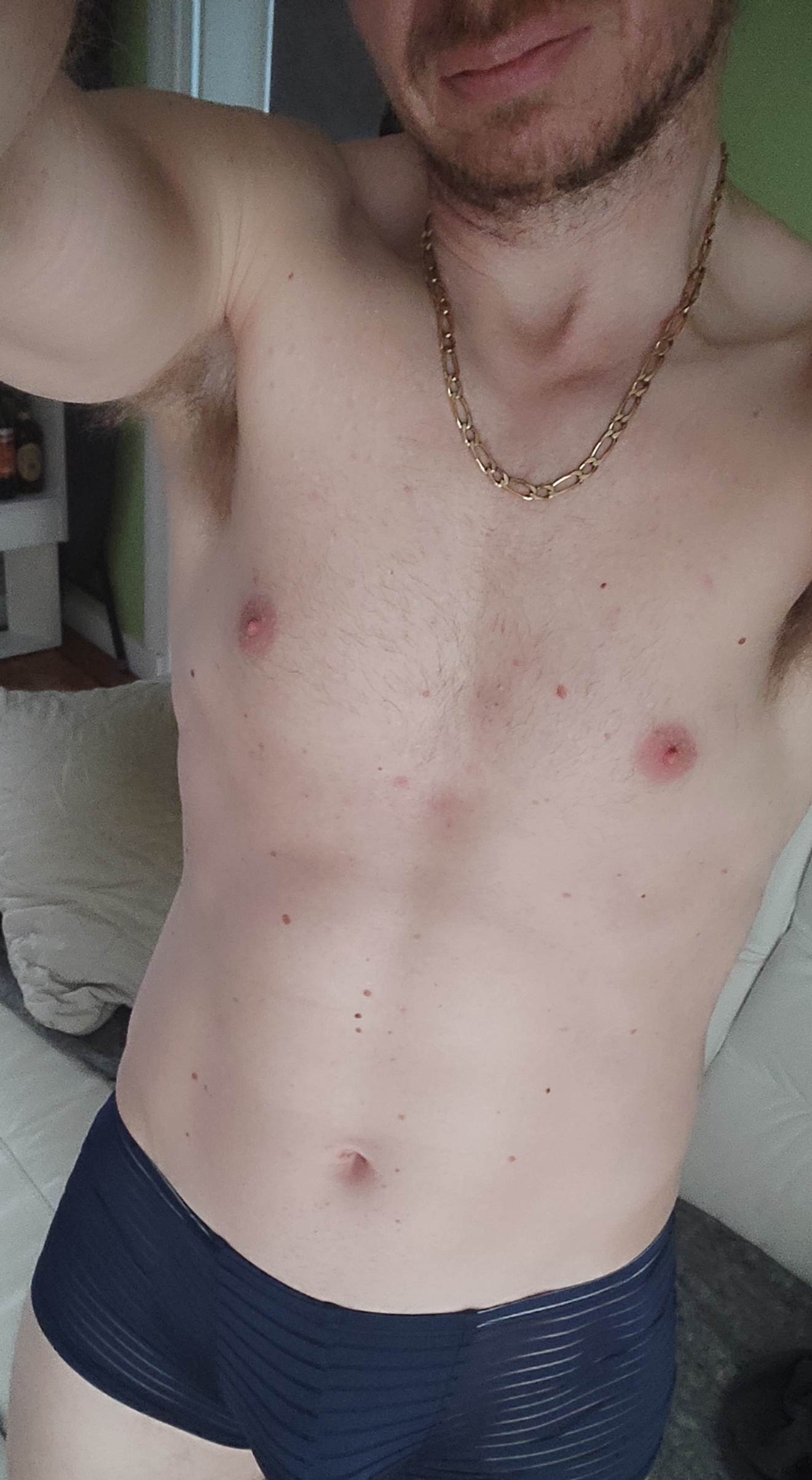 Bernus - Rüdlingen - Schaffhouse | Strip Tease