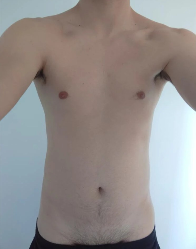 Eirik - Réchy - Valais | Strip Tease